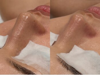 フロムミー 銀座本店(FROM ME)/ブラックモッチ