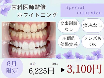 ホワイトニングカフェ 相模大野店(WhiteningCafe)の写真