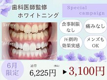 ホワイトニングカフェ 相模大野店(WhiteningCafe)