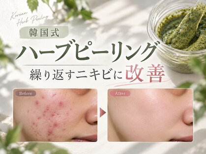 ベル 四条大宮(Belle)の写真