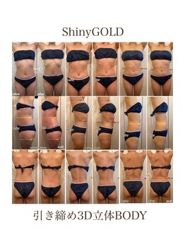 シャイニーゴールド 新所沢店(Shiny GOLD)/引き締め３D立体BODY