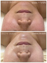 ルルボーテ(Loulou Beaute)/waxxxx＋VOSサロンケア