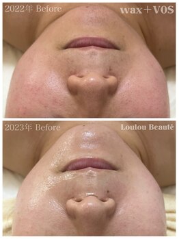 ルルボーテ(Loulou Beaute)/waxxxx+VOSサロンケア