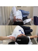 ナオル整体 三宮院(NAORU整体)/40代男性整体事例【肩背中痛】