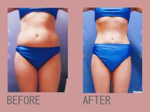 ジュリア オージェ 天王寺店/ビフォーアフターエンダモロジー