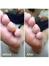 リゼラアンドコー 相模大野店/ドイツ式フットケア専門店