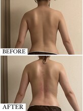 フェミニー(Feminy)/一回でクッキリ！！