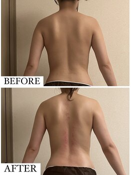 フェミニー(Feminy)/一回でクッキリ！！