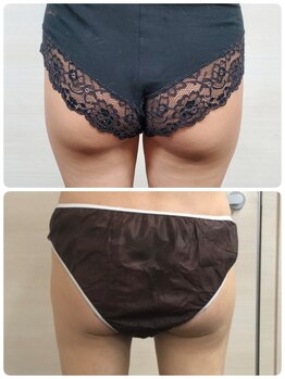 全身脱毛専門店 ten/Fit Carving