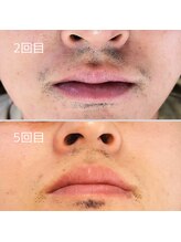 エイプリルプラス(April plus)/美眉　ハリウッドブロウリフト