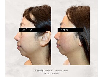 エスポワールカルド(Espoir caldo)/