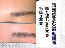 エステビビ 町田店(エステBiBi)の雰囲気（光脱毛だけじゃない！わかりやすい脱毛効果！　町田/町田脱毛）