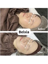 ベルシア(Belxia)/陶肌トリートメント症例