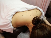 同心整体院の雰囲気（体の鍼灸もご予約承っております！）