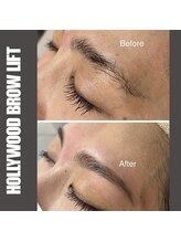 セラス(CERAS)/ハリウッドブロウリフト