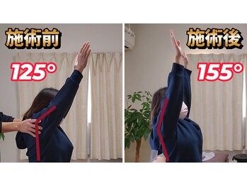 スタイルフリー/40代　肩こり