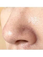 ラ ドウ 名古屋黒川店(la.dow)/毛穴洗浄コース・1回目