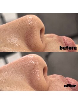 サラ(Sala)/アンプルフェイシャルワックス