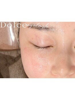 毛穴ケアをしたい