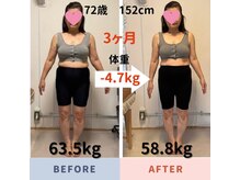 ナチュールフィット(Natur Fit)/72歳　ビフォーアフター