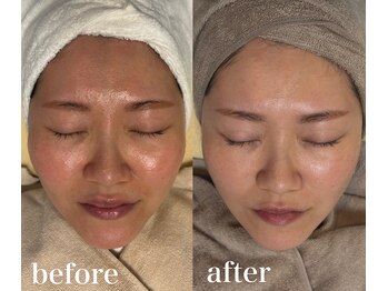 ウンスイスパ(UNSUI SPA)/くすみ撃退したい人はこれ！