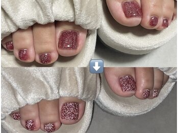 フラッシュネイル フット