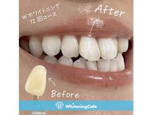 ホワイトニングカフェ 市川店(Whitening Cafe)の雰囲気（ホワイトニングを継続的な照射で理想な白さをGET☆）