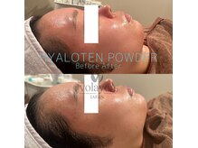 ワイズデュー(Y's Dew)