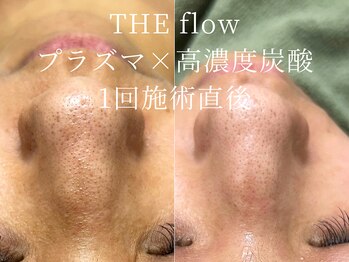 ザ フロウ(THE flow)/敏感肌やニキビにお悩みの方