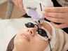 【効果◎施術漏れなし】女性★顔脱毛★3,300円★毛穴が気になる方ぜひ★