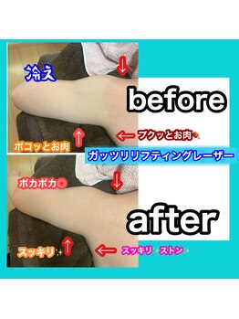 ビューティ ウィッチ(Beauty Witch)/3種類ヘッドで効果抜群◎