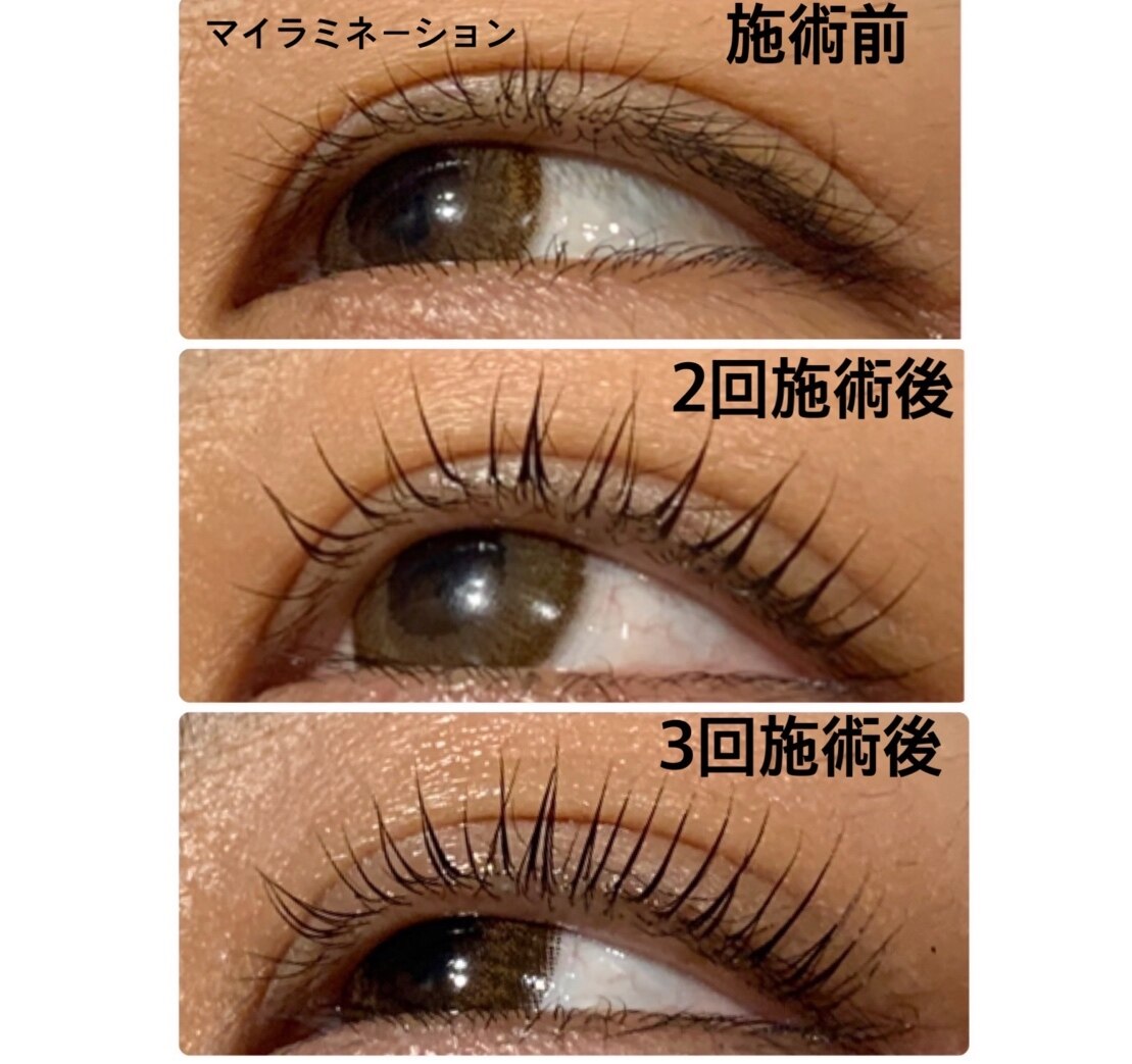 C039410436.jpg?impolicy=