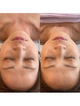 ララルアナ(Lara luana)/食いしばりや不眠のケアに