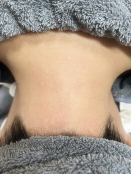 サロン インプルーヴ 久留米店(Salon improve)の写真/ベテランスタッフが丁寧に施術【うなじWAX＋光脱毛】都度払いで通いやすい◎