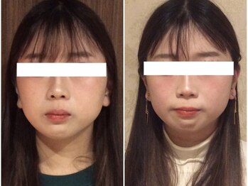 美容整体ウェリナ 名駅院/小顔矯正/骨盤矯正/美脚サロン