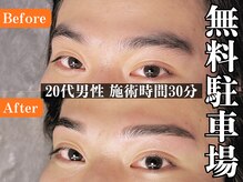 ヒゲ脱毛、全身脱毛、VIO脱毛、眉毛専門#脱毛#メンズ脱毛