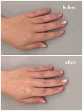 オテテ アイアンドハンド(otete eye&hand)/ハンドケアビフォーアフター