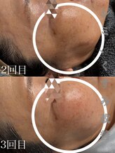 リツイート(ReTweet)