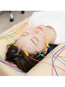 ピアーズ鍼灸整骨院/美容鍼