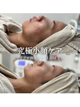 イロハ(IROHA)/２回の施術効果◎