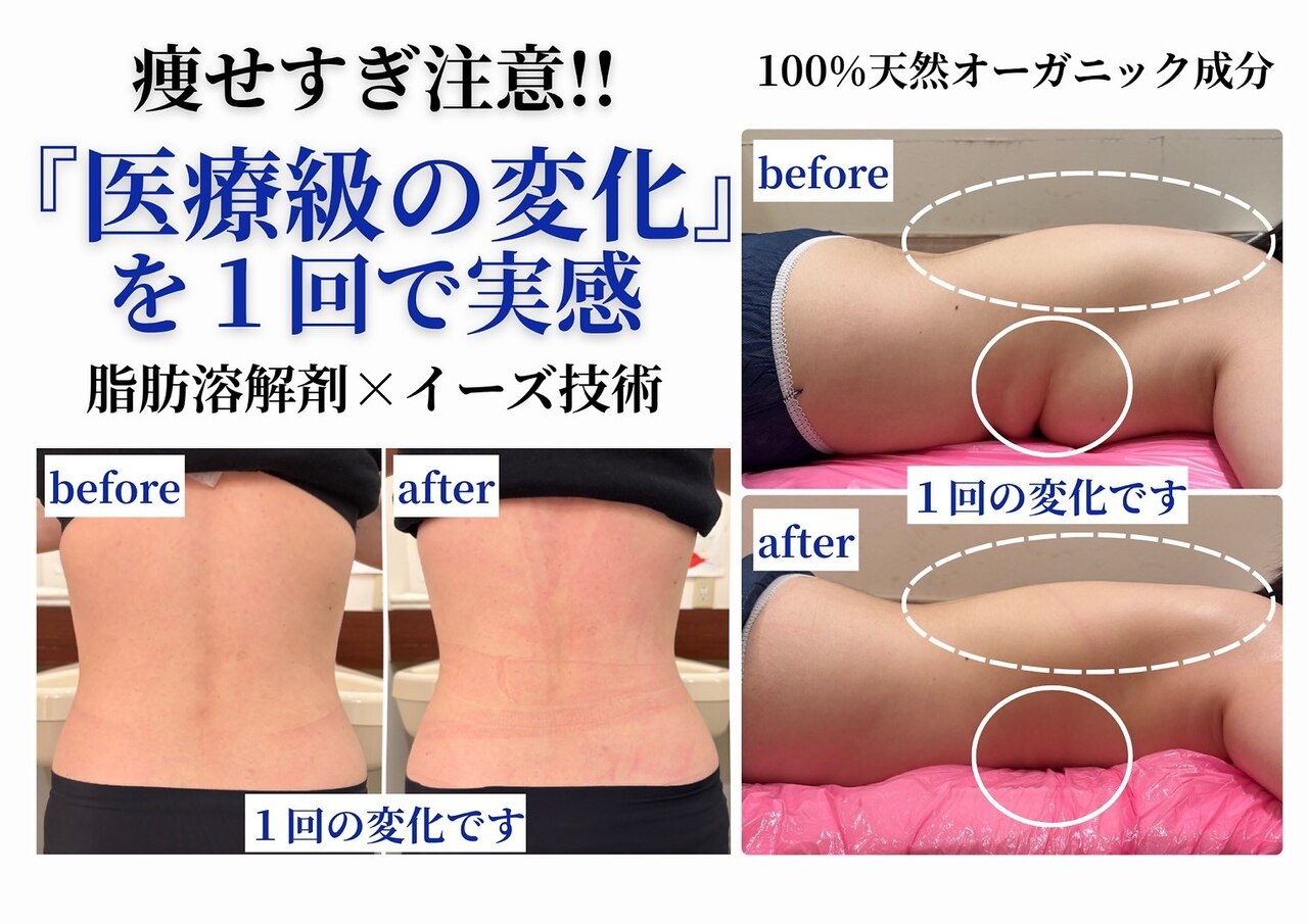 井尻駅でエンダモロジーが人気のエステサロン｜ホットペッパービューティー