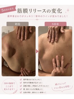 ルフレの写真/《お身体の歪み/ねじれをスッキリ》首肩の筋肉を深層から解きほぐす♪筋膜リリース☆初回限定☆60分￥9,800