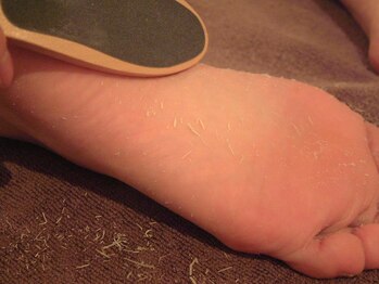 リュクシー(LUXEY)/【フットケア　角質除去】