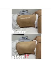 エクスクラメーションマーク(!!!)/ボディー