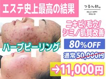 つるん肌。 博多筑紫口店の雰囲気（人気No,1☆ハーブピーリング!ニキビケア/毛穴などの肌管理に♪）