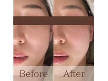 凪眠の雰囲気（ビフォーアフター写真はブログ、フォトギャラリーに多数掲載中！）