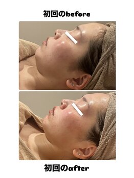 グレッシュ &nbsp;弘前店(Gresh)/wiQoの効果写真