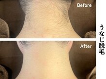 ギルドハナレ(GUILD HANARE)/"自信が持てる後ろ姿に"