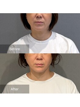 プライミー(PRIMY)/お顔の歪み