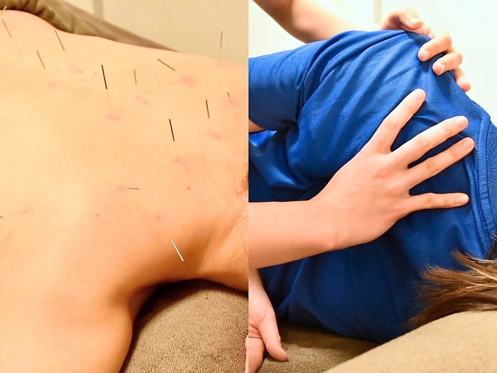 DMSトータルケア全身調整60分\9900→\6990　《鍼＋整体SET》
